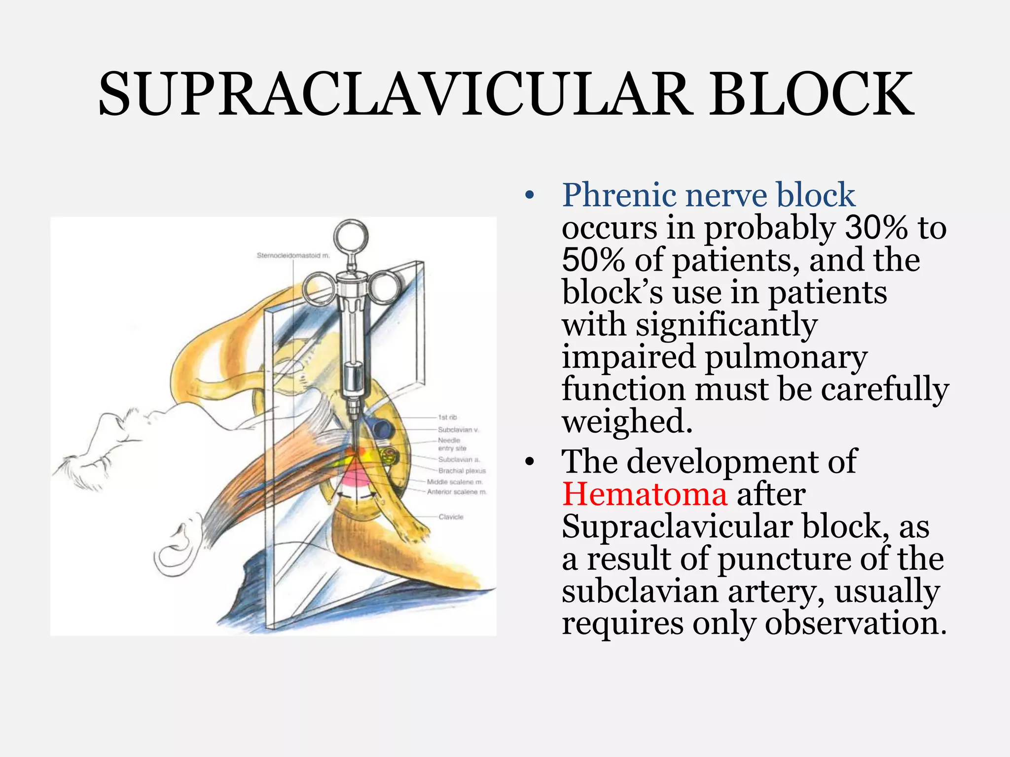 SUPRACLAVICULAR BLOCK
• Phrenic nerve block
occurs in probably 30% to
50% of patients, and the
block’s use in patients
with significantly
impaired pulmonary
function must be carefully
weighed.
• The development of
Hematoma after
Supraclavicular block, as
a result of puncture of the
subclavian artery, usually
requires only observation.
 