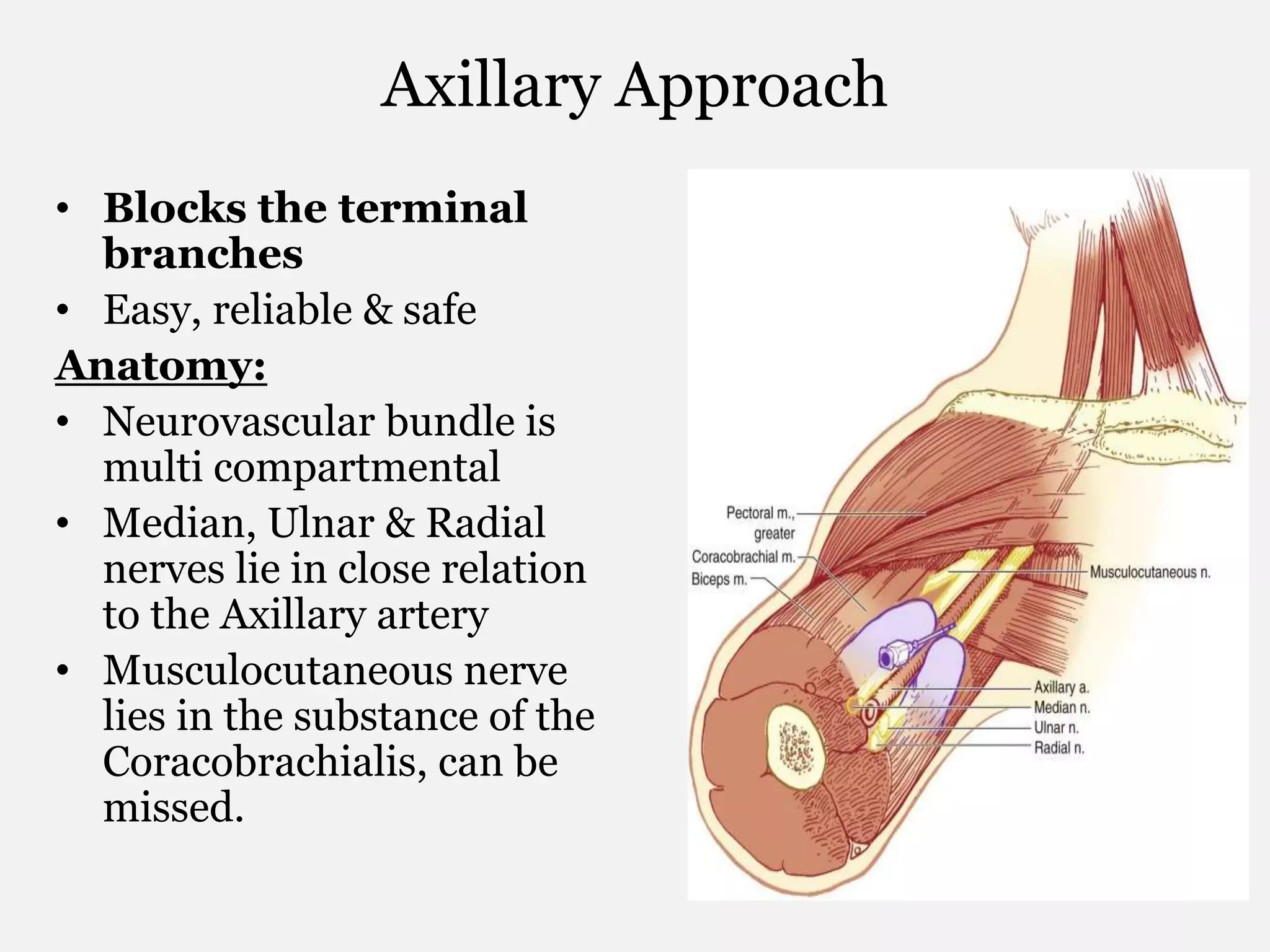 Axillary Approach
• Blocks the terminal
branches
• Easy, reliable & safe
Anatomy:
• Neurovascular bundle is
multi compartmental
• Median, Ulnar & Radial
nerves lie in close relation
to the Axillary artery
• Musculocutaneous nerve
lies in the substance of the
Coracobrachialis, can be
missed.
 
