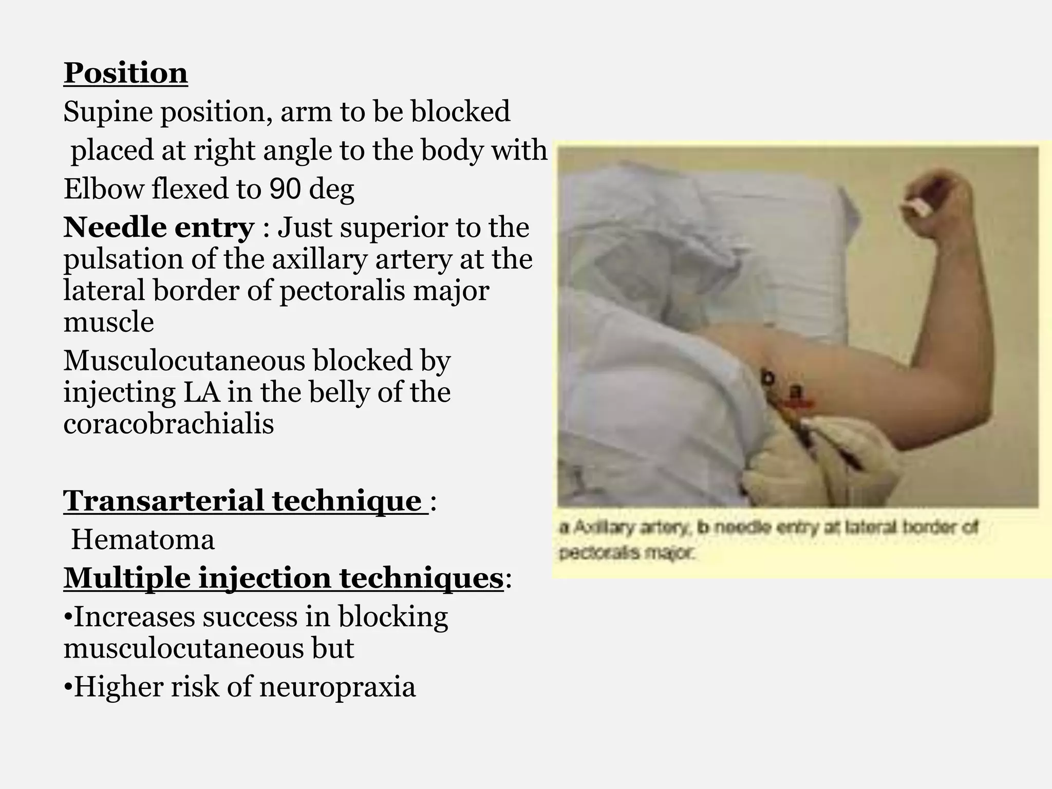 Position
Supine position, arm to be blocked
placed at right angle to the body with
Elbow flexed to 90 deg
Needle entry : Just superior to the
pulsation of the axillary artery at the
lateral border of pectoralis major
muscle
Musculocutaneous blocked by
injecting LA in the belly of the
coracobrachialis
Transarterial technique :
Hematoma
Multiple injection techniques:
•Increases success in blocking
musculocutaneous but
•Higher risk of neuropraxia
 