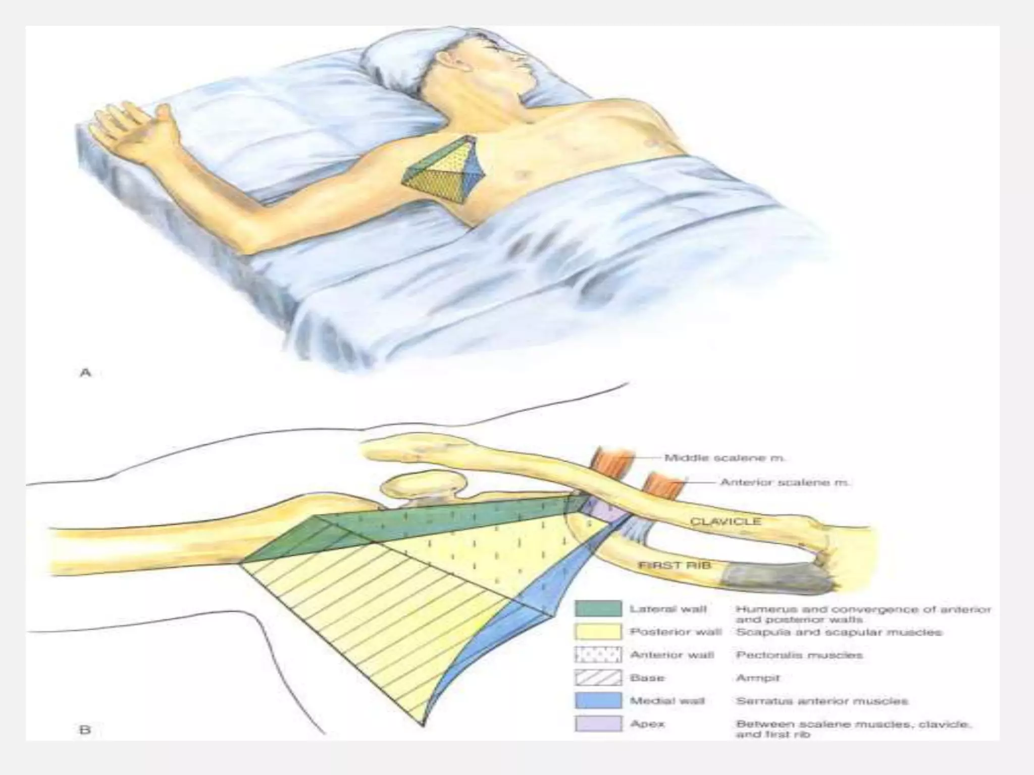 INFRA CLAVICULAR BOCK
 