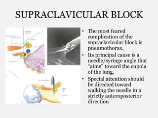SUPRACLAVICULAR BLOCK
• The most feared
complication of the
supraclavicular block is
pneumothorax.
• Its principal cause is a
needle/syringe angle that
“aims” toward the cupola
of the lung.
• Special attention should
be directed toward
walking the needle in a
strictly anteroposterior
direction
 