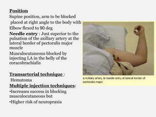 Position
Supine position, arm to be blocked
placed at right angle to the body with
Elbow flexed to 90 deg
Needle entry : Just superior to the
pulsation of the axillary artery at the
lateral border of pectoralis major
muscle
Musculocutaneous blocked by
injecting LA in the belly of the
coracobrachialis
Transarterial technique :
Hematoma
Multiple injection techniques:
•Increases success in blocking
musculocutaneous but
•Higher risk of neuropraxia
 