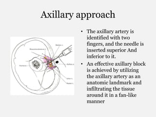 Axillary approach
• The axillary artery is
identified with two
fingers, and the needle is
inserted superior And
inferior to it.
• An effective axillary block
is achieved by utilizing
the axillary artery as an
anatomic landmark and
infiltrating the tissue
around it in a fan-like
manner
 