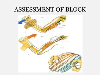ASSESSMENT OF BLOCK
 