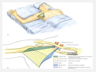 INFRA CLAVICULAR BOCK
 