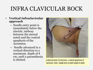 INFRA CLAVICULAR BOCK
• Vertical Infraclavicular
approach
– Needle entry point is
immediately below the
clavicle, midway
between the sternal
notch and the ventral
apophysis of the
Acromion.
– Needle advanced in a
vertical direction to a
maximum. depth of 4
cm, until a paraesthesia
is elicited.
 