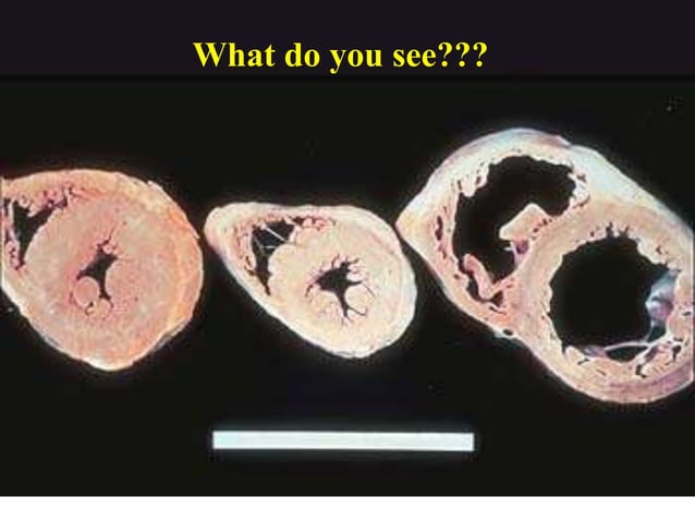 01 Cardiac Pathology Ppt Free Download