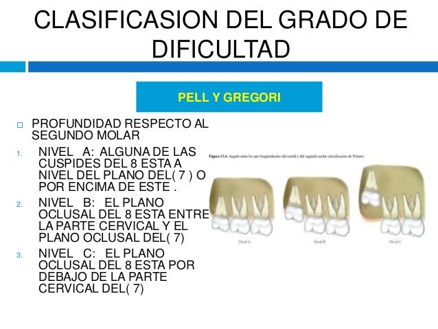 cirugia de terceros molares