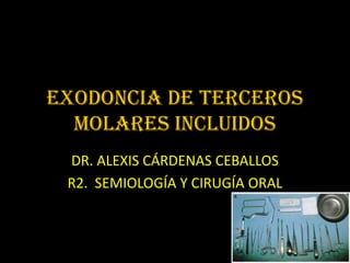 Exodoncia DE TERCEROS
  MOLARES incluidos
 DR. ALEXIS CÁRDENAS CEBALLOS
 R2. SEMIOLOGÍA Y CIRUGÍA ORAL
 