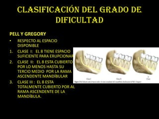 CLASIFICACIÓN DEL GRADO DE
             DIFICULTAD
PELL Y GREGORY
•    RESPECTO AL ESPACIO
     DISPONIBLE
1.   CLASE I: EL 8 TIENE ESPACIO
     SUFICIENTE PARA ERUPCIONAR
2.   CLASE II: EL 8 ESTA CUBIERTO
     POR LO MENOS HASTA SU
     TERCIO MEDIO POR LA RAMA
     ASCENDENTE MANDÍBULAR
3.   CLASE III : EL 8 ESTA
     TOTALMENTE CUBIERTO POR AL
     RAMA ASCENDENTE DE LA
     MANDÍBULA.
 