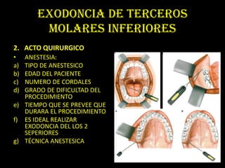 EXODONCIA DE TERCEROS
        MOLARES INFERIORES
2. ACTO QUIRURGICO
•  ANESTESIA:
a) TIPO DE ANESTESICO
b) EDAD DEL PACIENTE
c) NUMERO DE CORDALES
d) GRADO DE DIFICULTAD DEL
   PROCEDIMIENTO
e) TIEMPO QUE SE PREVEE QUE
   DURARA EL PROCEDIMIENTO
f) ES IDEAL REALIZAR
   EXODONCIA DEL LOS 2
   SEPERIORES
g) TÉCNICA ANESTESICA
 