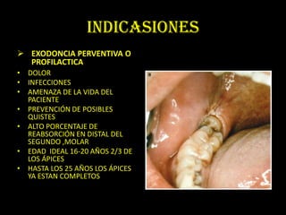 INDICASIONES
 EXODONCIA PERVENTIVA O
  PROFILACTICA
• DOLOR
• INFECCIONES
• AMENAZA DE LA VIDA DEL
  PACIENTE
• PREVENCIÓN DE POSIBLES
  QUISTES
• ALTO PORCENTAJE DE
  REABSORCIÓN EN DISTAL DEL
  SEGUNDO ,MOLAR
• EDAD IDEAL 16-20 AÑOS 2/3 DE
  LOS ÁPICES
• HASTA LOS 25 AÑOS LOS ÁPICES
  YA ESTAN COMPLETOS
 