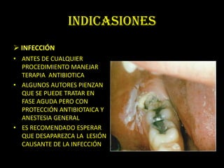 INDICASIONES
 INFECCIÓN
• ANTES DE CUALQUIER
  PROCEDIMIENTO MANEJAR
  TERAPIA ANTIBIOTICA
• ALGUNOS AUTORES PIENZAN
  QUE SE PUEDE TRATAR EN
  FASE AGUDA PERO CON
  PROTECCIÓN ANTIBIOTAICA Y
  ANESTESIA GENERAL
• ES RECOMENDADO ESPERAR
  QUE DESAPAREZCA LA LESIÓN
  CAUSANTE DE LA INFECCIÓN
 