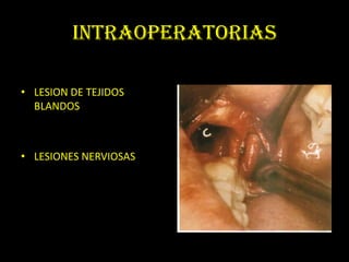 INTRAOPERATORIAS

• LESION DE TEJIDOS
  BLANDOS



• LESIONES NERVIOSAS
 