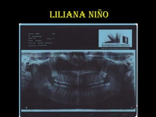 LILIANA NIÑO
 