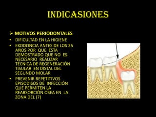INDICASIONES
 MOTIVOS PERIODONTALES
• DIFICULTAD EN LA HIGIENE
• EXODONCIA ANTES DE LOS 25
  AÑOS POR QUE ESTA
  DEMOSTRADO QUE NO ES
  NECESARIO REALIZAR
  TÉCNICA DE REGENERACIÓN
  TISULAR EN DISTAL DEL
  SEGUNDO MOLAR
• PREVENIR REPETITIVOS
  EPISODISOS DE INFECCIÓN
  QUE PERMITEN LA
  REABSORCIÓN OSEA EN LA
  ZONA DEL (7)
 