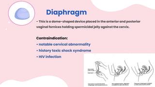 Diaphragm
- This is a dome-shaped device placed in the anterior and posterior
vaginal fornices holding spermicidal jelly against the cervix.
Contraindication:
• notable cervical abnormality
• history toxic shock syndrome
• HIV infection
 