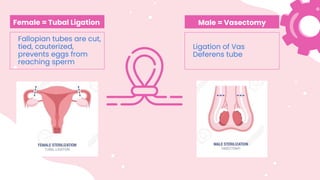 Female = Tubal Ligation
Fallopian tubes are cut,
tied, cauterized,
prevents eggs from
reaching sperm
Male = Vasectomy
Ligation of Vas
Deferens tube
 