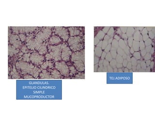 GLANDULAS.
EPITELIO CILINDRICO
SIMPLE
MUCOPRODUCTOR
TEJ.ADIPOSO
 