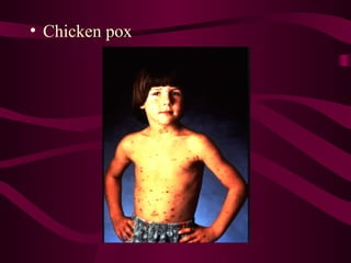 Understanding Diseases: Causes, Types, and Effects on Health | PPT
