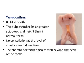 Bull Tooth 01 Disorders of development of teeth and craniofacial anomalies.pptx
