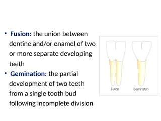 01 Disorders of development of teeth and craniofacial anomalies.pptx