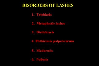 DISORDERS OF LASHES

   1. Trichiasis

   2. Metaplastic lashes

   3. Distichiasis

   4. Phthiriasis palpebrarum

   5. Madarosis

   6. Poliosis
 