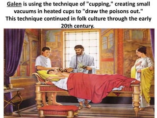 Galen is using the technique of "cupping," creating small
vacuums in heated cups to "draw the poisons out."
This technique continued in folk culture through the early
20th century.
 