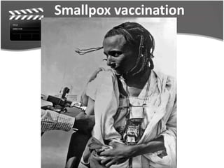 Smallpox vaccination
 