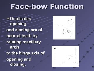 01 facebows | PPT