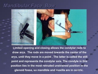 Condylar Rods 01 facebows and Articulators | PPT