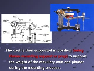 Hanua Modular Mouting 01 facebows and Articulators | PPT