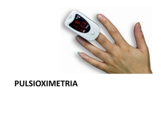 PULSIOXIMETRIA
 