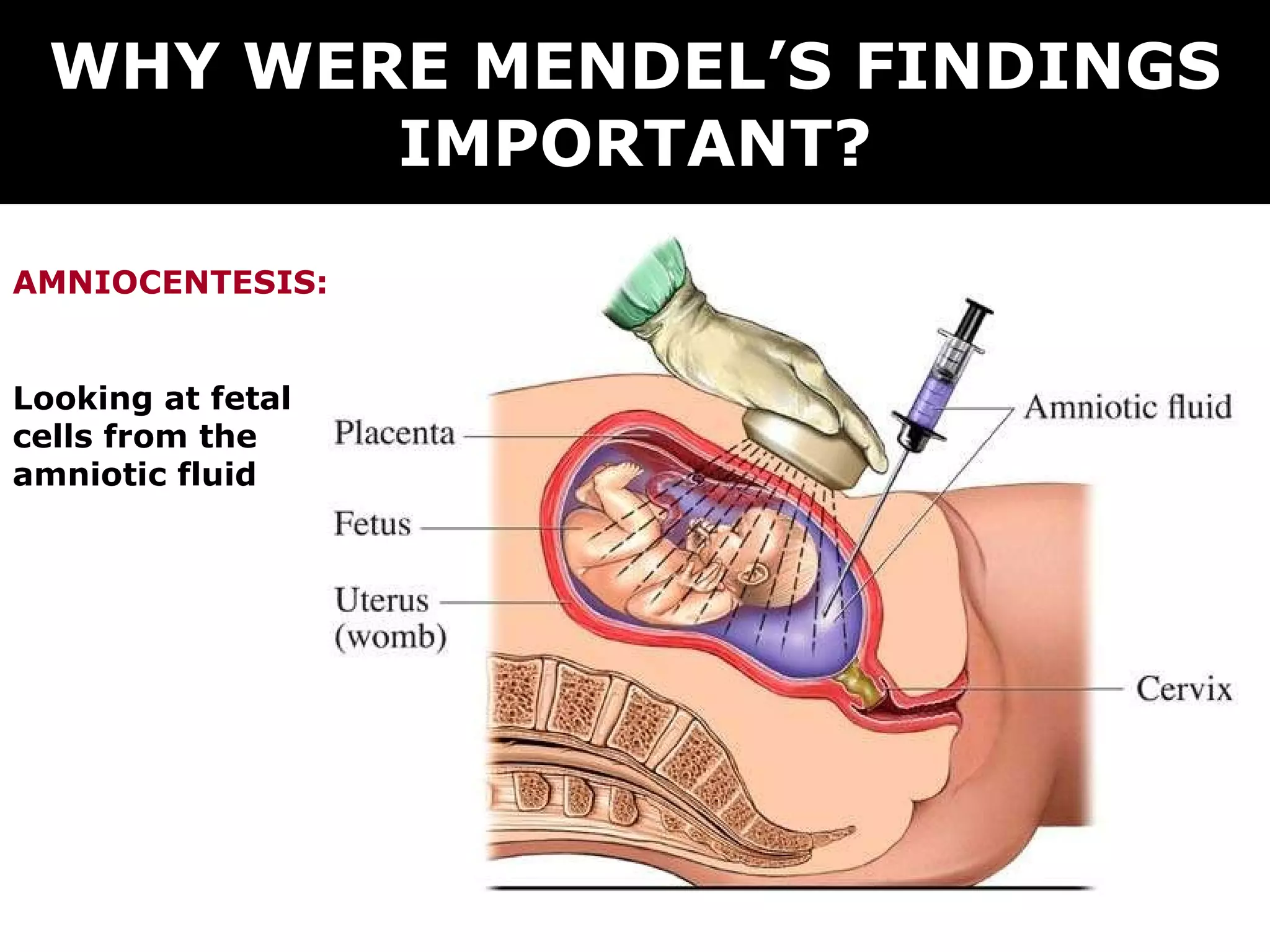 WHY WERE MENDEL’S FINDINGS IMPORTANT? AMNIOCENTESIS: Looking at fetal cells from the amniotic fluid 