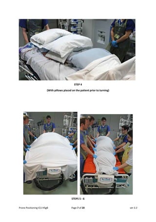 Prone Positioning in the Intubated Adult ICU Patient