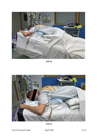 Prone Positioning in the Intubated Adult ICU Patient