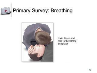 Primary Survey: Breathing 