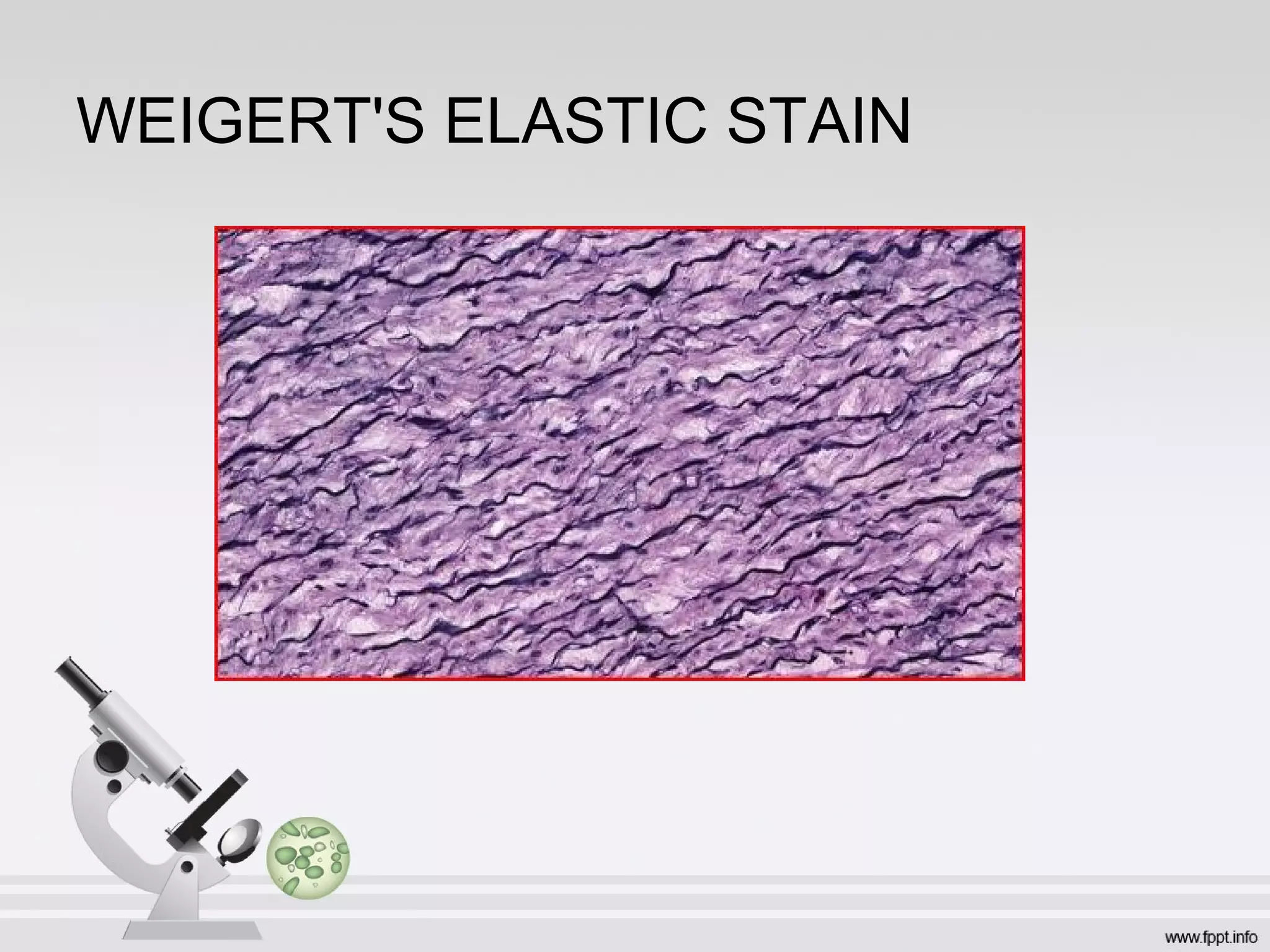 WEIGERT'S ELASTIC STAIN
 