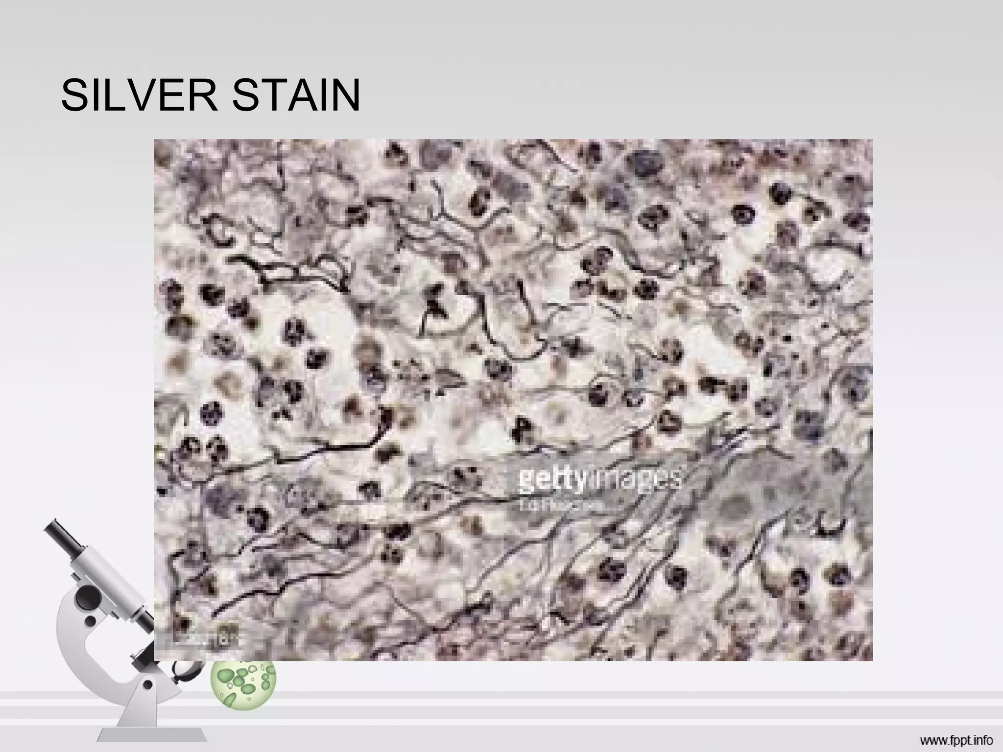 SILVER STAIN
 