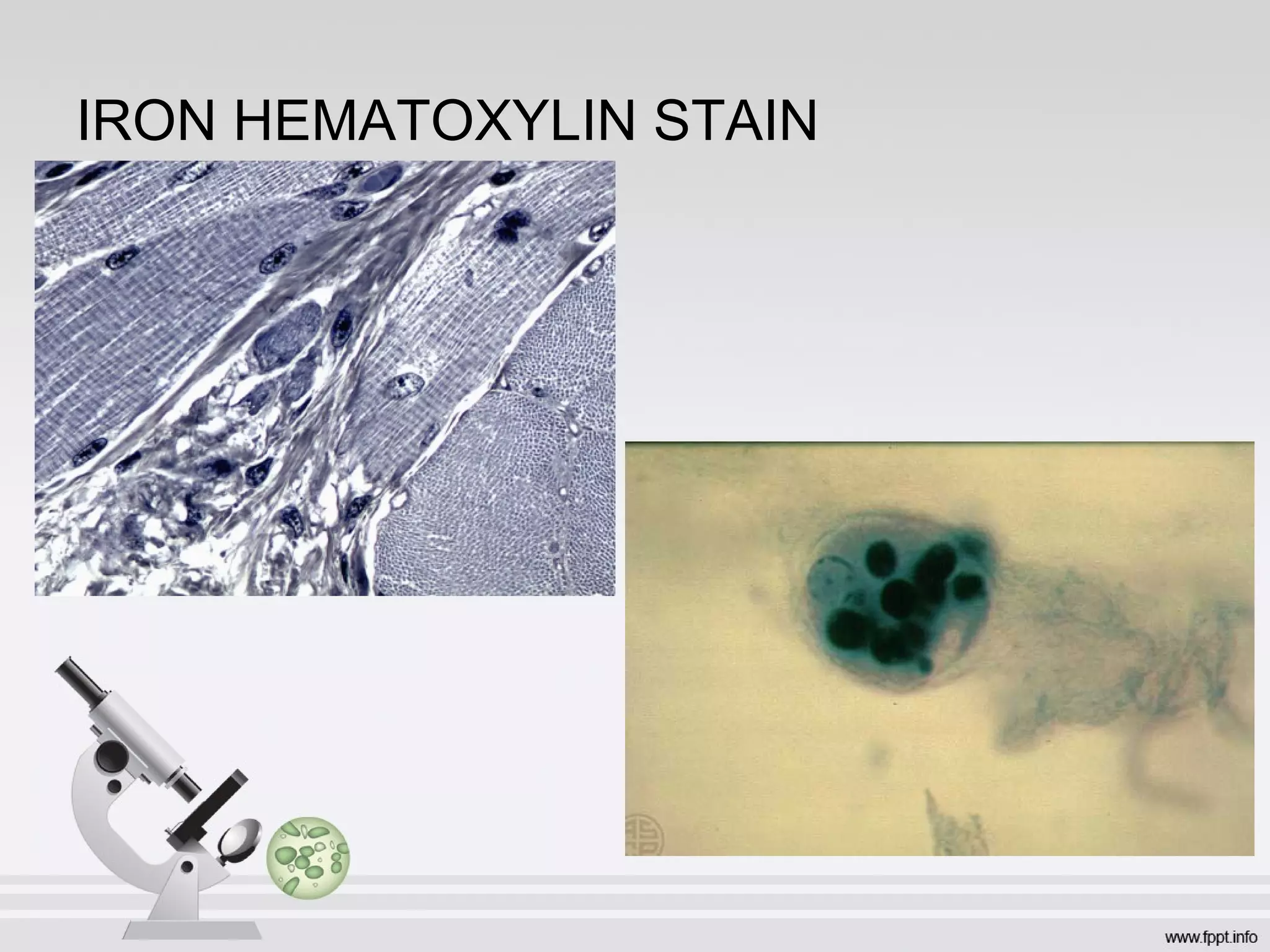 IRON HEMATOXYLIN STAIN
 