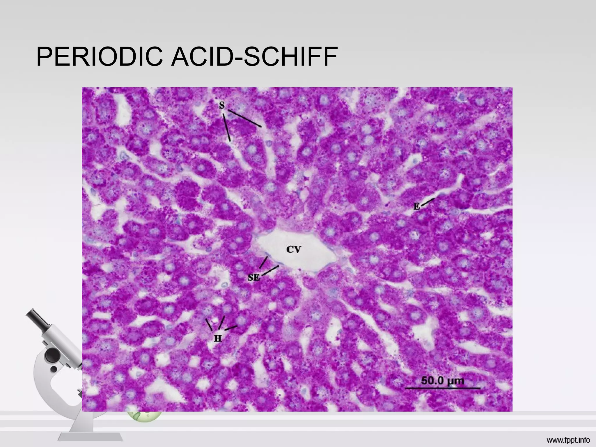 PERIODIC ACID-SCHIFF
 