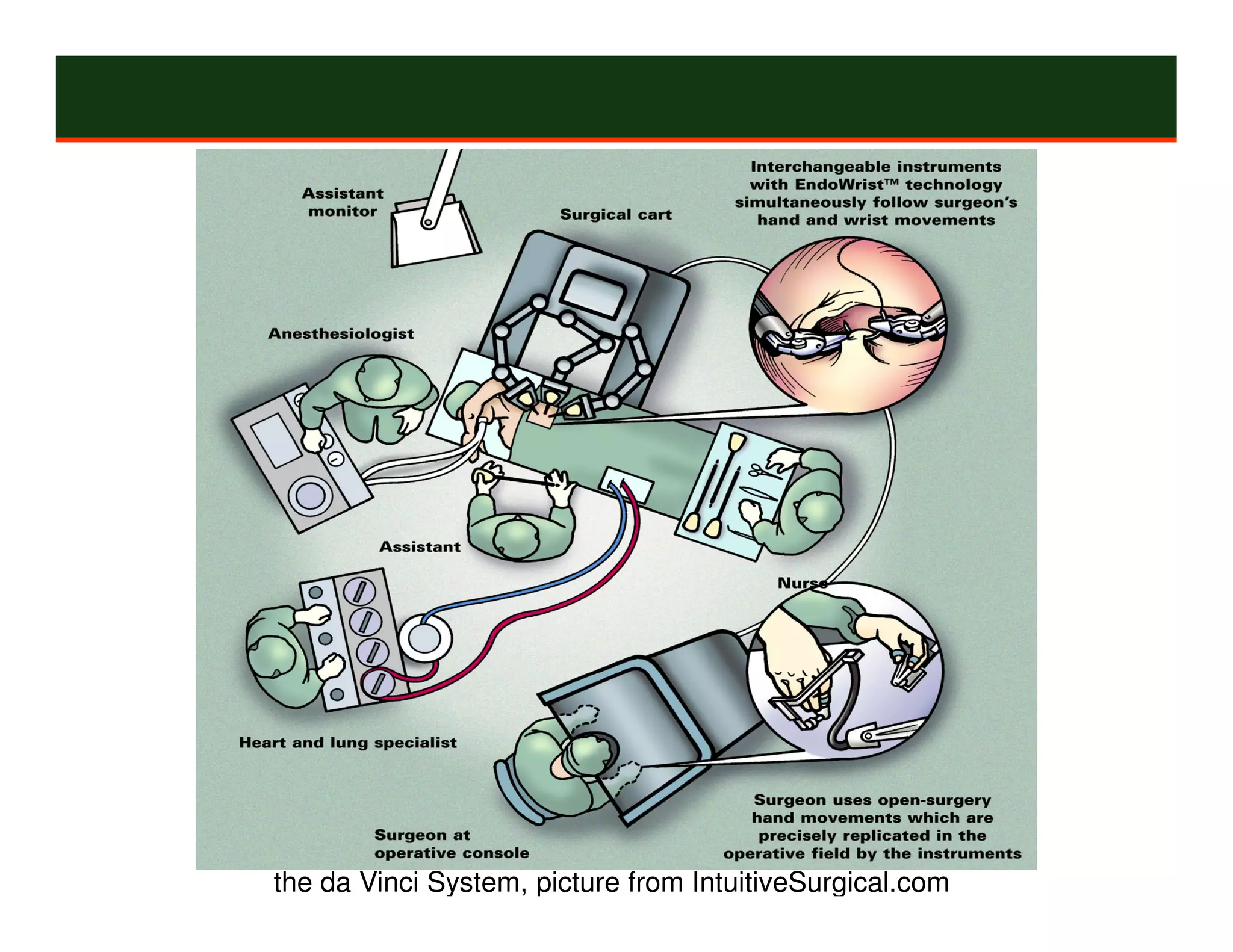 the da Vinci System, picture from IntuitiveSurgical.com
 