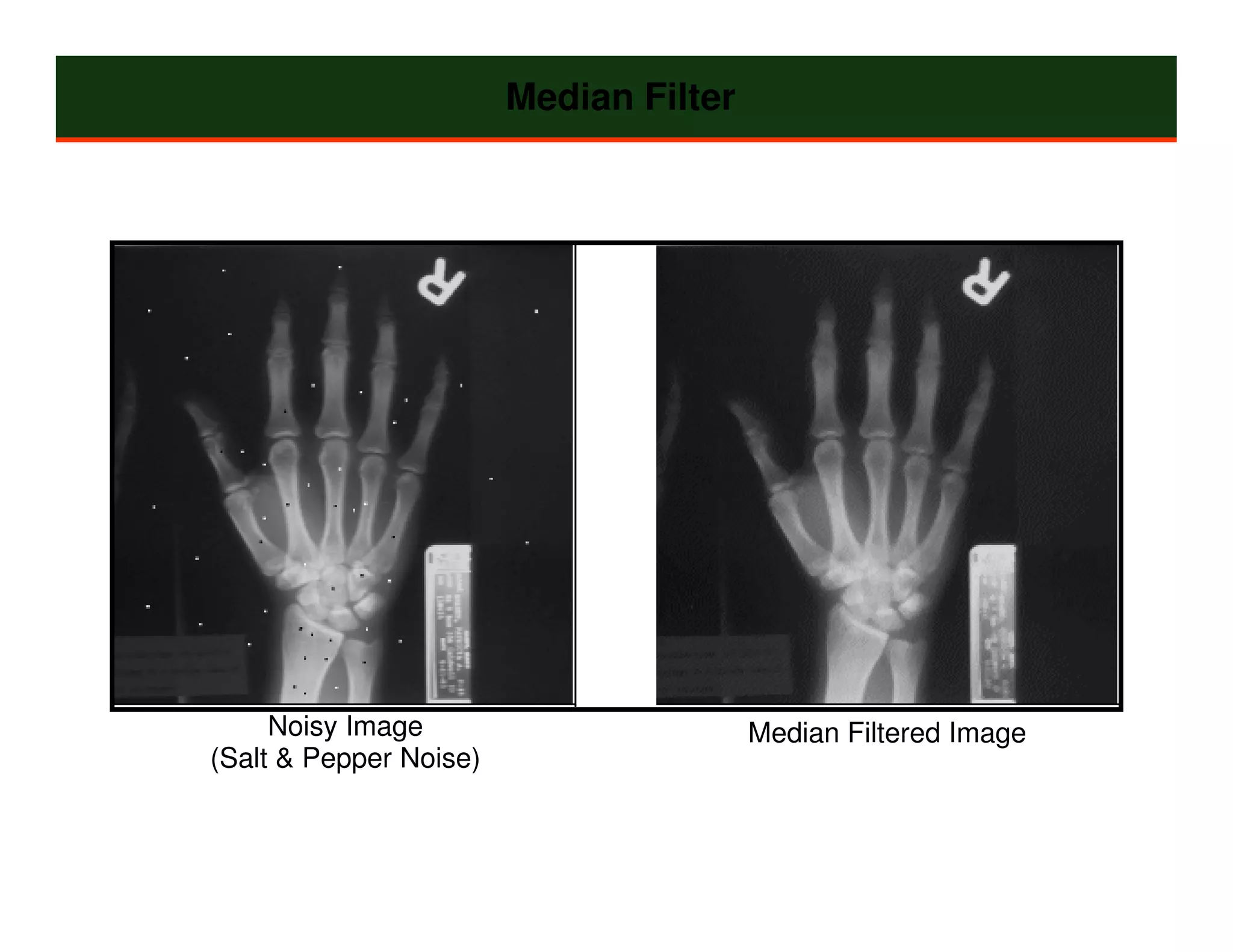 Median Filter




     Noisy Image                        Median Filtered Image
(Salt & Pepper Noise)
 
