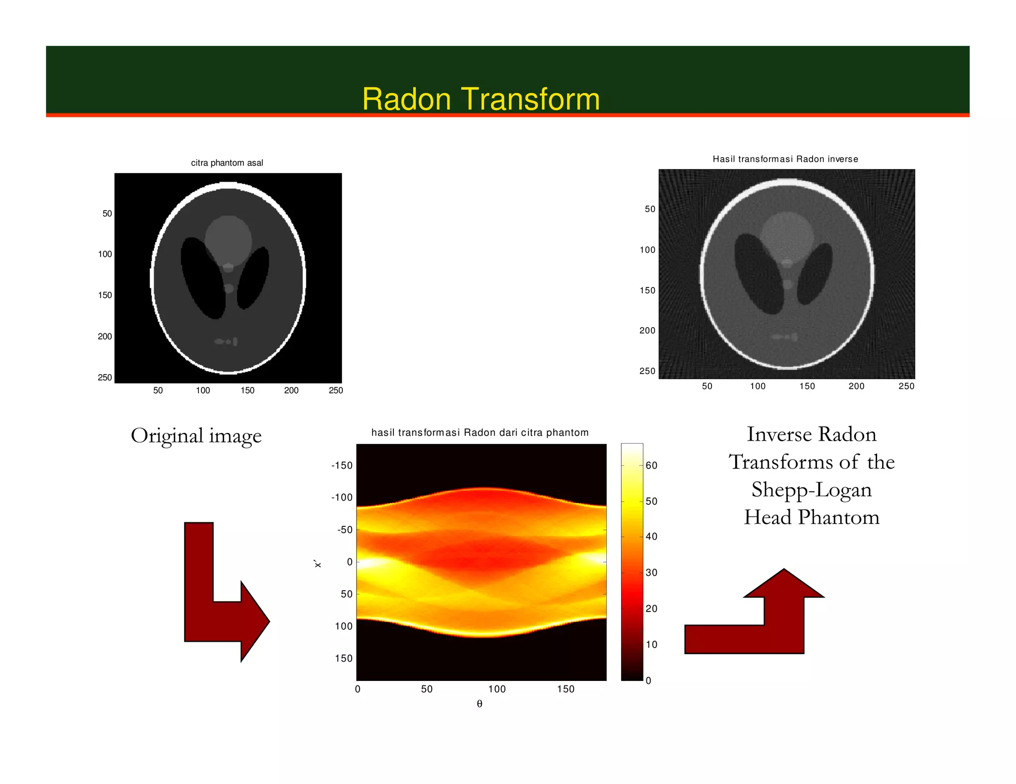 Radon Transform
             citra phantom asal                                                                                          Has il trans form as i Radon invers e




                                                                                                               50
 50



100                                                                                                           100



                                                                                                              150
150



200                                                               Radon Transform                             200


                                                                  of Head Phantom                             250
250
        50    100        150      200        250                      Using 90                                      50            100          150         200   250


                                                                     Projections
      Original image                                       has il trans form as i Radon dari c itra phantom
                                                                                                                               Inverse Radon
                                             -150                                                              60            Transforms of the
                                             -100                                                              50
                                                                                                                                Shepp-Logan
                                              -50
                                                                                                                              Head Phantom
                                                                                                               40

                                                   0
                                        x′




                                                                                                               30

                                               50
                                                                                                               20
                                              100
                                                                                                               10
                                              150

                                                                                                               0
                                                       0             50               100          150
                                                                                  θ
 
