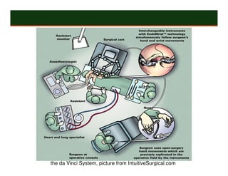 the da Vinci System, picture from IntuitiveSurgical.com
 
