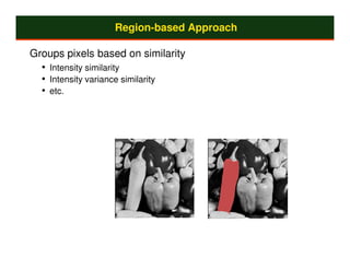 Region-based Approach

Groups pixels based on similarity
  • Intensity similarity
  • Intensity variance similarity
  • etc.
 