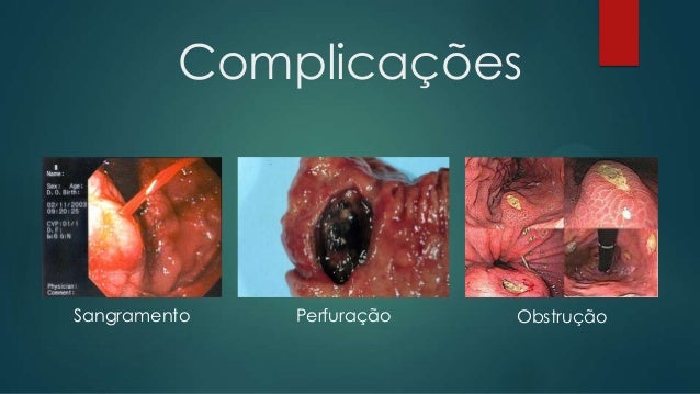 Quero deixar de fumar mas não posso como deixar de fumar