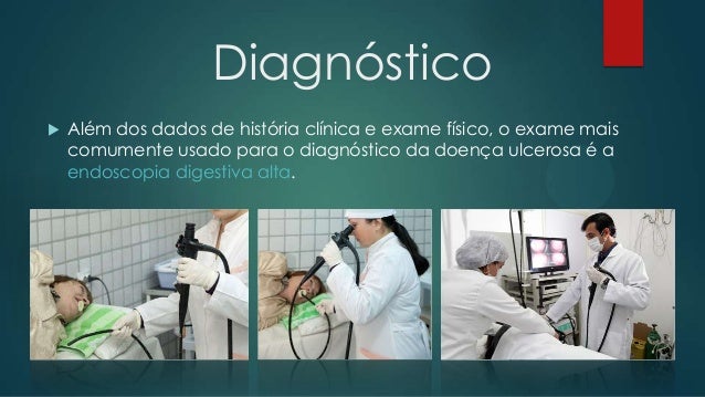Pastilhas brizantin método de aplicação