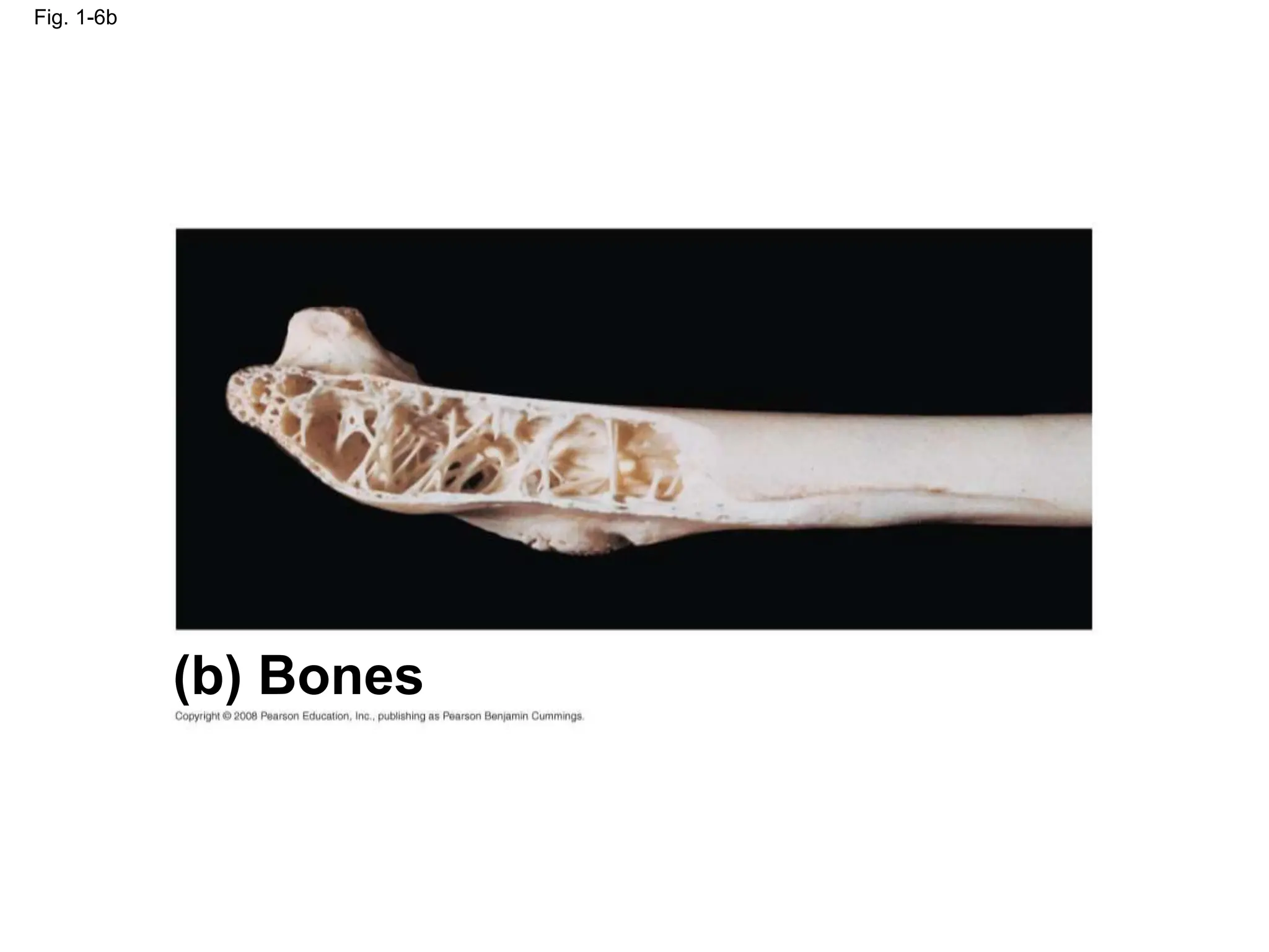 Fig. 1-6b
(b) Bones
 