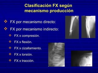 Clasificación FX segúnClasificación FX según
mecanismo producciónmecanismo producción
 FX por mecanismo directo:FX por mecanismo directo:
 FX por mecanismo indirecto:FX por mecanismo indirecto:
 FX x compresión.FX x compresión.
 FX x flexión.FX x flexión.
 FX x cizallamiento.FX x cizallamiento.
 FX x torsión.FX x torsión.
 FX x tracción.FX x tracción.
 